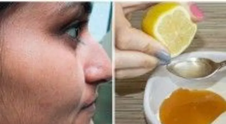 15 minutos para quitar tu vello facial para siempre, con esta sencilla receta 