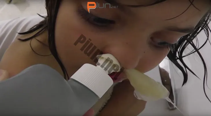 Cómo eliminar la sinusitis en solo 1 día. ASOMBROSO!