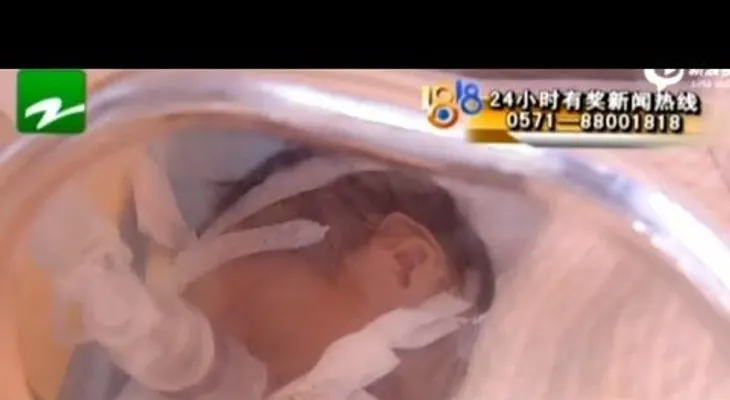 Un bebé declarado muerto despierta antes de ser incinerado (VIDEO)