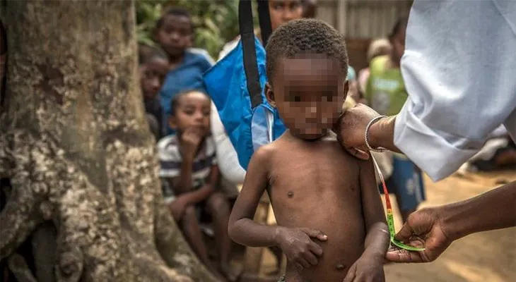  Malnutrición retrasa el crecimiento de 155 millones de niños, según informe 