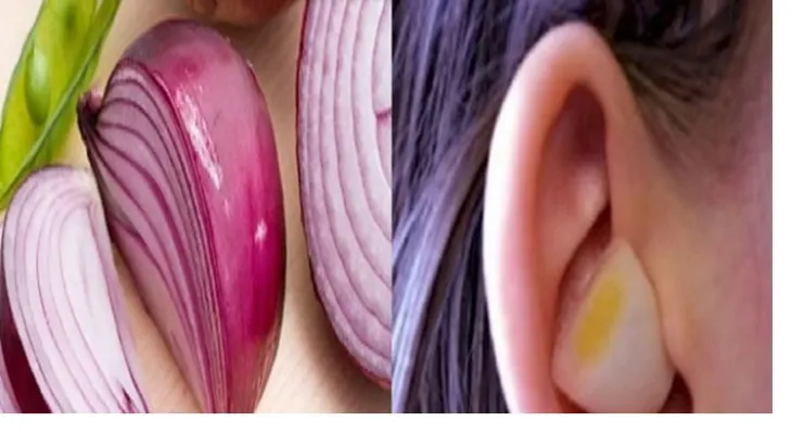 La cebolla no sólo te hace llorar: Te cura de resfriados, tos, friebre, otitis y dolor de oído