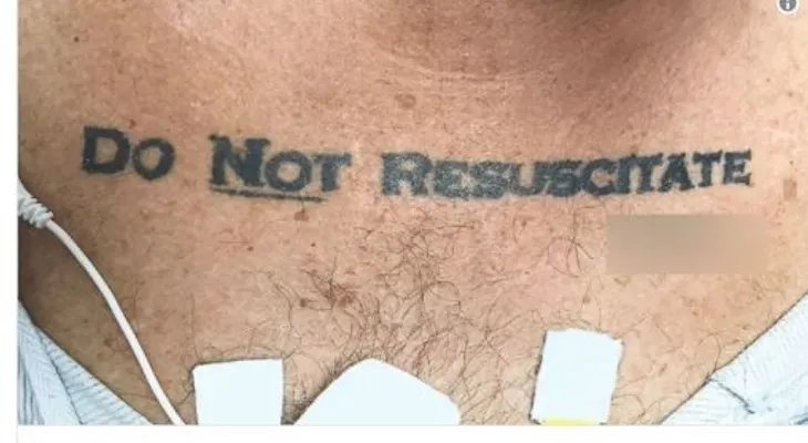 Un hombre llega inconsciente al hospital con un tatuaje escrito: "No resucitar" y deja perplejos a los médicos