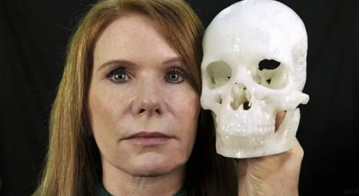 Atajo para cirugía del cerebro: hacerlo a través del párpado