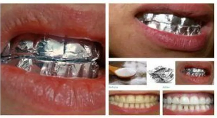 Un sencillo truco con papel aluminio en los dientes por 60 minutos y mira lo que pasa (hombre o mujer)