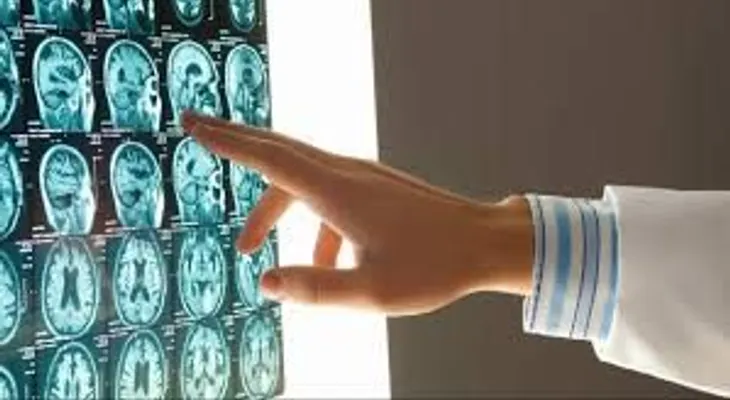  Un robot diagnostica tumores cerebrales con más certeza que 15 médicos