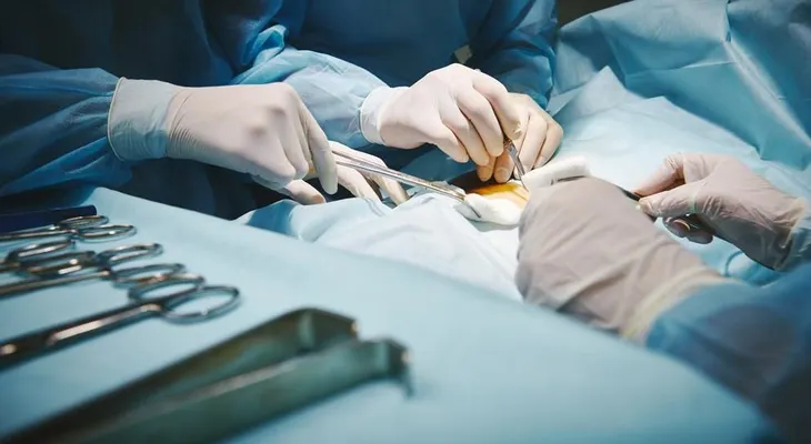 Hallan un cerebro dentro de un tumor de ovarios en una joven de 16 años