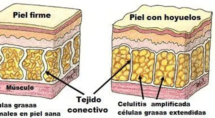 Disminuir la celulitis con esta bebida secreta