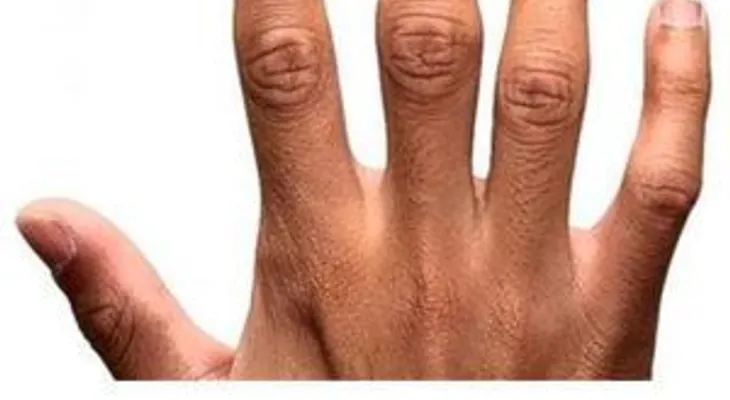 El dedo índice y anular marcaría una tendencia a ser lesbianas; un estudio revela que SÍ, ¿Tú, qué opina?