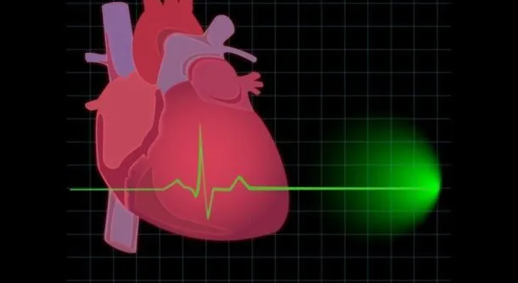 5 actividades que pueden provocar un infarto y no conocías