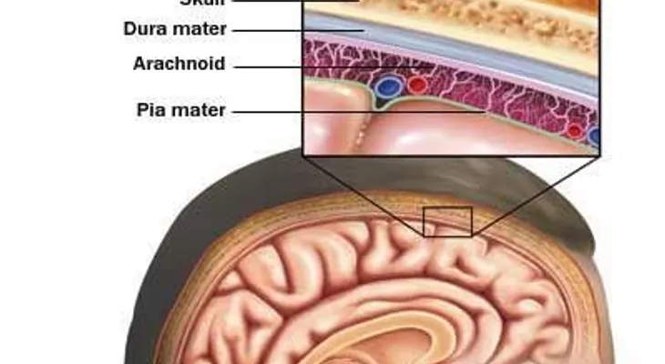 Mueren de meningitis hombres que tuvieron sexo con otros hombres