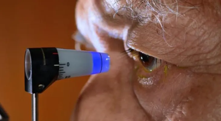  Solo 20 por ciento casos de glaucoma presentan síntomas, alerta especialista 