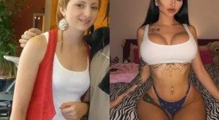 Era víctima del bullying y gastó millones en cirugías para convertirse en modelo top en Instagram