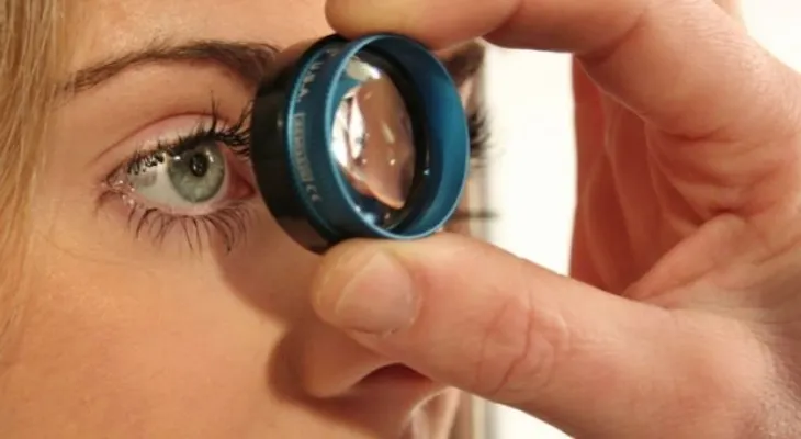 ¿Qué es el glaucoma y quiénes tienen más probabilidades de tenerlo? 