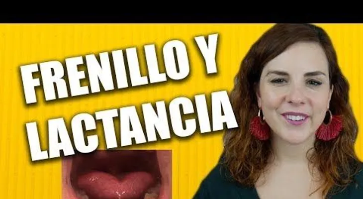 ¿Cómo afecta la LACTANCIA con el FRENILLO corto?