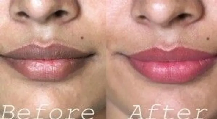 Increíble truco para blanquear labios oscuros naturalmente!