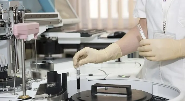 Científicos crean un gel que evitaría contagio de VIH