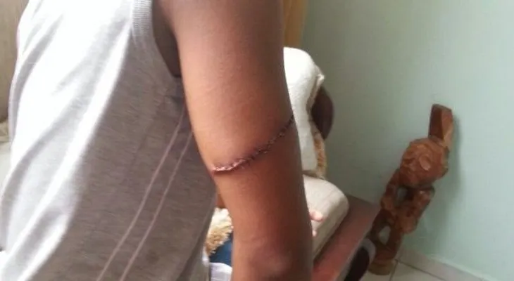 Envían a la cárcel haitiano macheteó hijo de periodista Erick Montilla