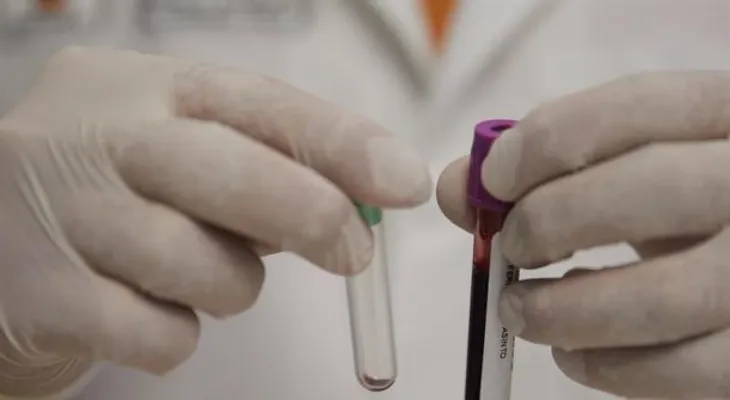 Científicos crean tatuaje biomédico que detecta altos niveles de calcio en sangre 