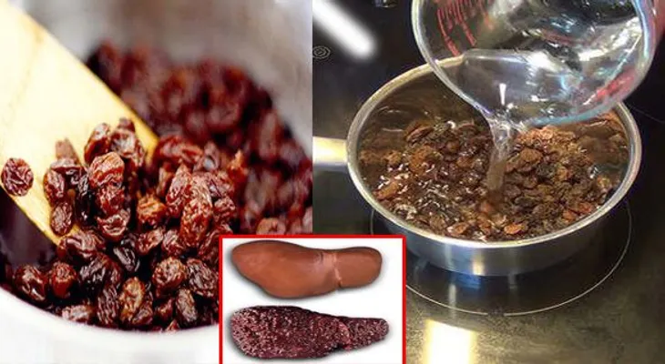 Forma correcta de preparar agua de pasas para depurar el hígado graso y eliminar toxinas del cuerpo