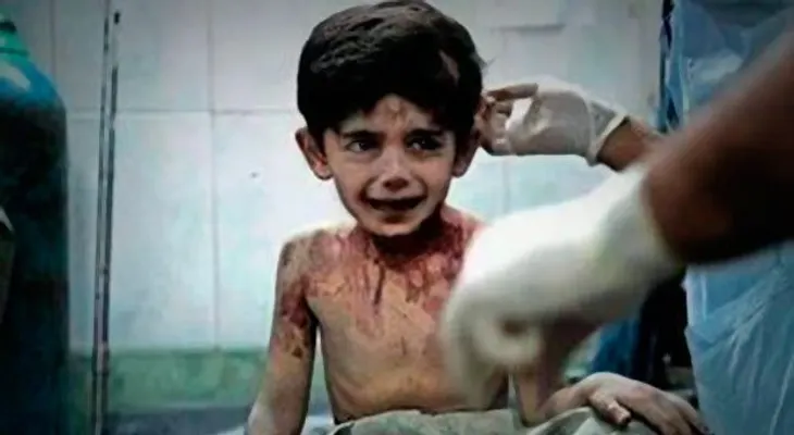 "Voy a contarle todo a Dios", dice un niño antes de morir en Siria