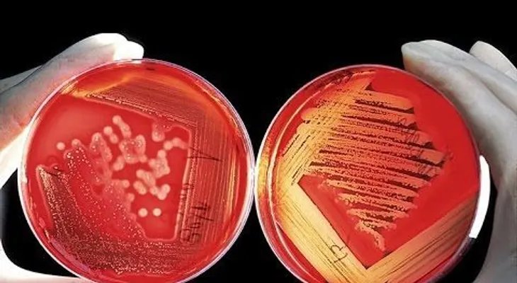 Revuelo científico: trasplantan con éxito en Rusia el primer órgano creado con bioimpresora 3D (VIDEO)