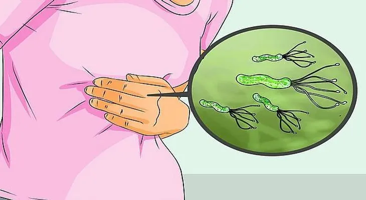 ¡Médico de Japón revela cómo matar bacteria Helicobacter Pylori de RAIZ!!..