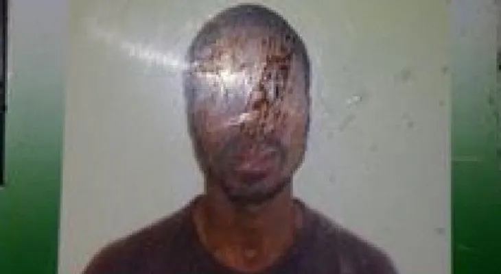 Mueren dos haitianos intoxicados en finca de Montecristi