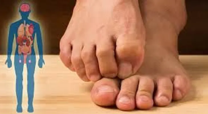 Lo que tus pies revelan sobre tu higado dañado 