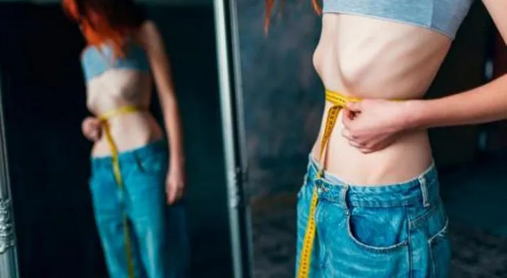 La anorexia también tiene un origen metabólico, no solo psiquiátrico