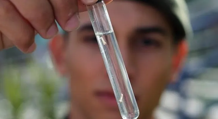 ¿Pueden vincular el zika y la microcefalia?