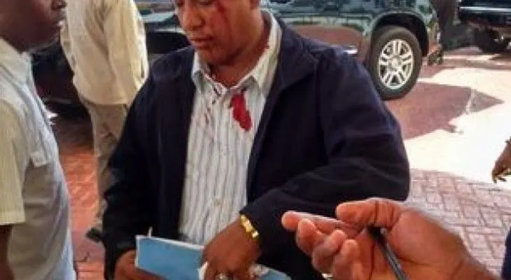 Agreden hombre a trompadas porque molestaba a Federico Antún Batlle