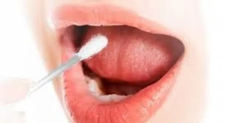  Científicos descubren sustancia en la saliva que ayuda a detectar cáncer oral 