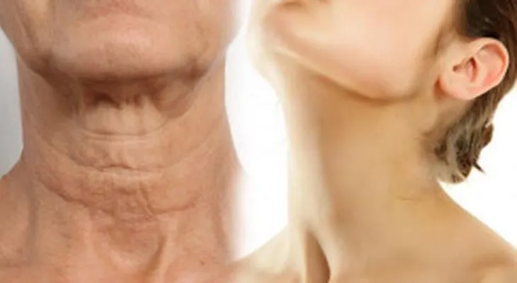 Descubre la manera más sencilla de hacer que tu cuello luzca joven. Es alucinante!