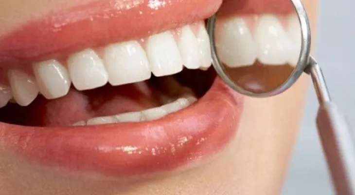 8 formas para reducir visitas al dentista 