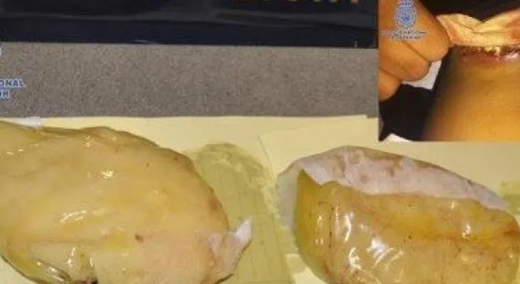 Apresan mujer llevaba cocaína en sus implantes de senos