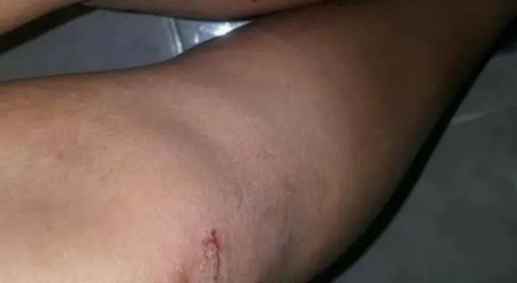 Una mujer se salva de "tablitas" de atracadores