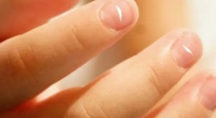 ¿Por qué aparecen las manchas blancas en las uñas? ¡Aquí la razón!