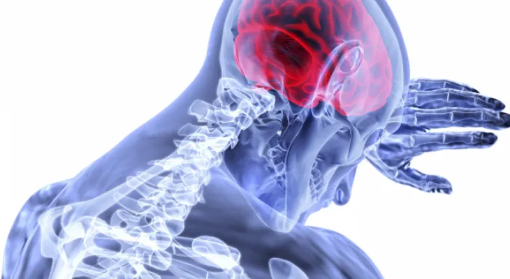 La epilepsia: Una afección común que afecta al cerebro