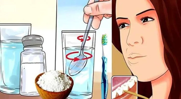 Este enjuague te eliminará en un minuto yagas, mal aliento, caries, sarro y placa de tu boca y dentadura