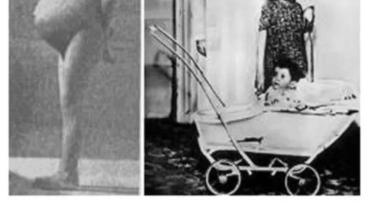 La niña que fue madre a los 5 años.