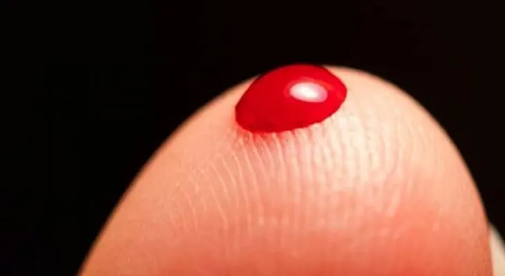 Niños con hemofilia aprenden a conocer su condición y prevenir complicaciones