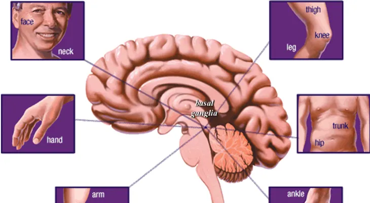 La enfermedad de parkinson; dormir en exceso puede ser un mal sintoma
