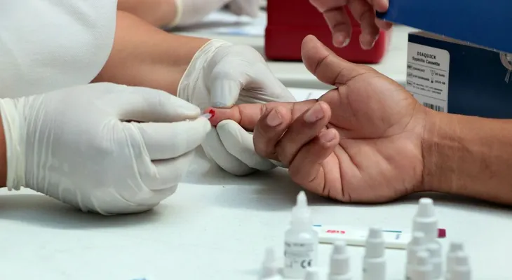 Al menos 95% de quienes viven con VIH se han infectado de papiloma humano