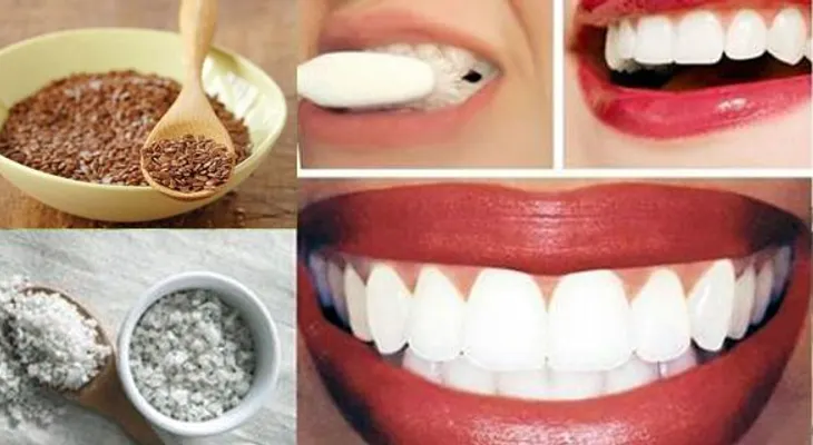 ¡Enjuaga tus dientes por 30 segundos con este remedio y elimina el sarro y la placa de los dientes!