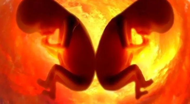 Increíble: mujer dio a luz a gemelos de dos padres diferentes