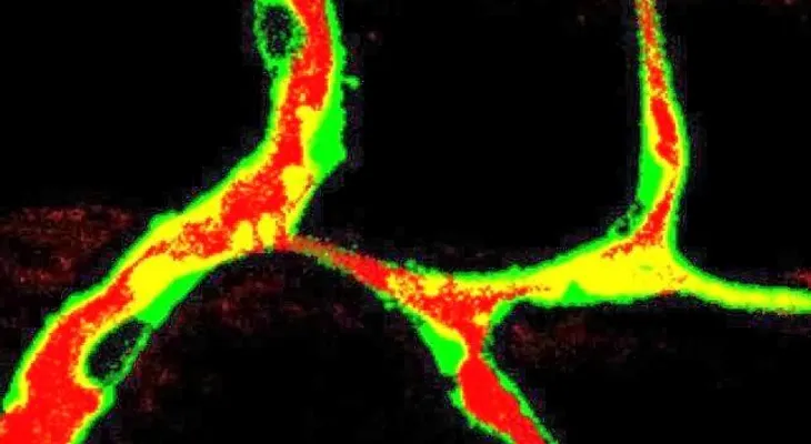 El colesterol alto fomenta el crecimiento del cáncer de mama