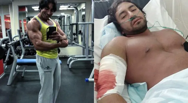 Conmoción por la muerte de fisicoculturista colombiano que se entrenaba en Rusia