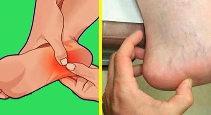 Si quieres que desaparezca el dolor en la planta de tus pies, sigue los siguientes pasos 