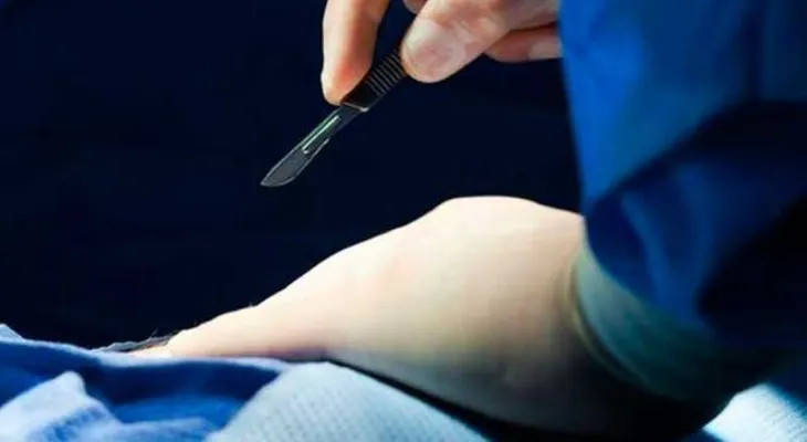 Hospital de Alabama le corta pene a un hombre por error