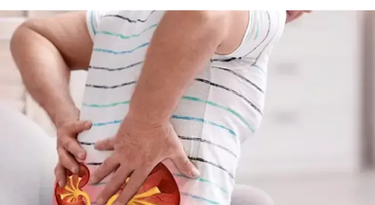 Suplementos en exceso ponen en riesgo los riñones